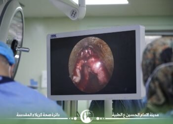 نجاح عملية إستئصال ورم كبير في حنجرة مريض كربلائي مُصاب بإلتهاب الكبد الفايروسي