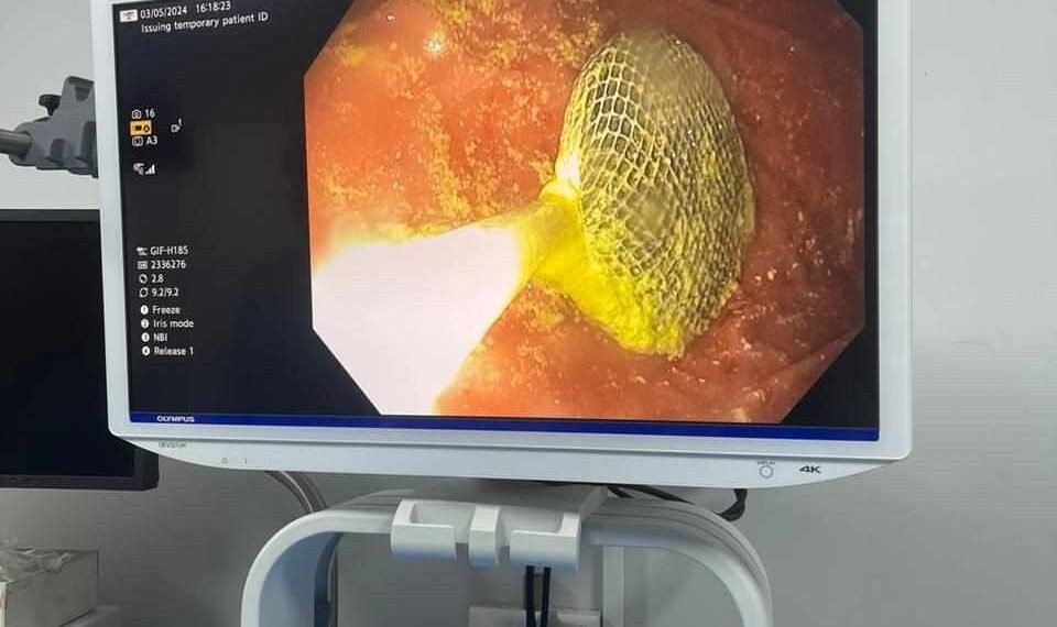 في كربلاء.. استخراج عملة معدنية من بلعوم طفل